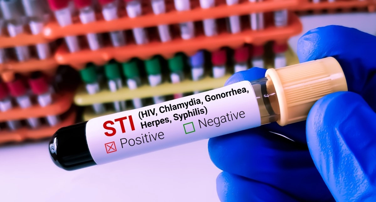 European countries are urged to update their strategies on sexually transmitted infections they are obsolete