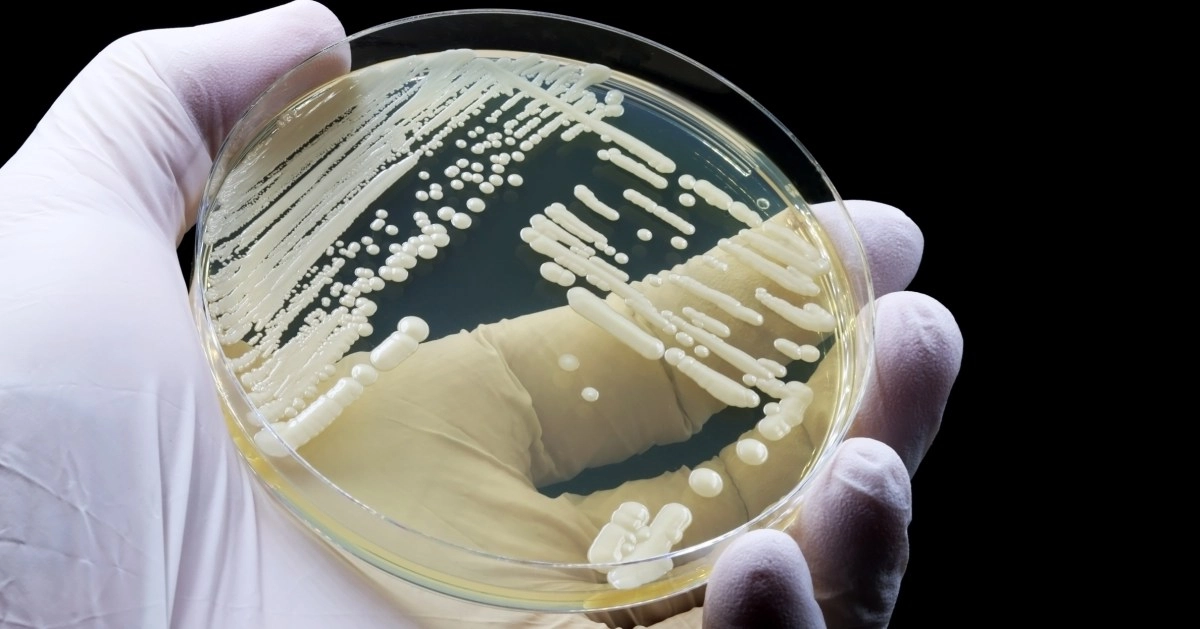 Deadly Fungus Candida auris Is Spreading Across the United States