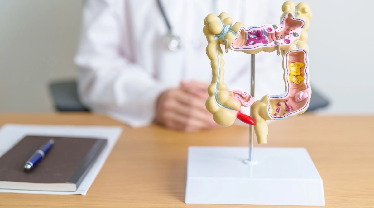 Colorectal cancer is the leading cause of cancer death in people under 50