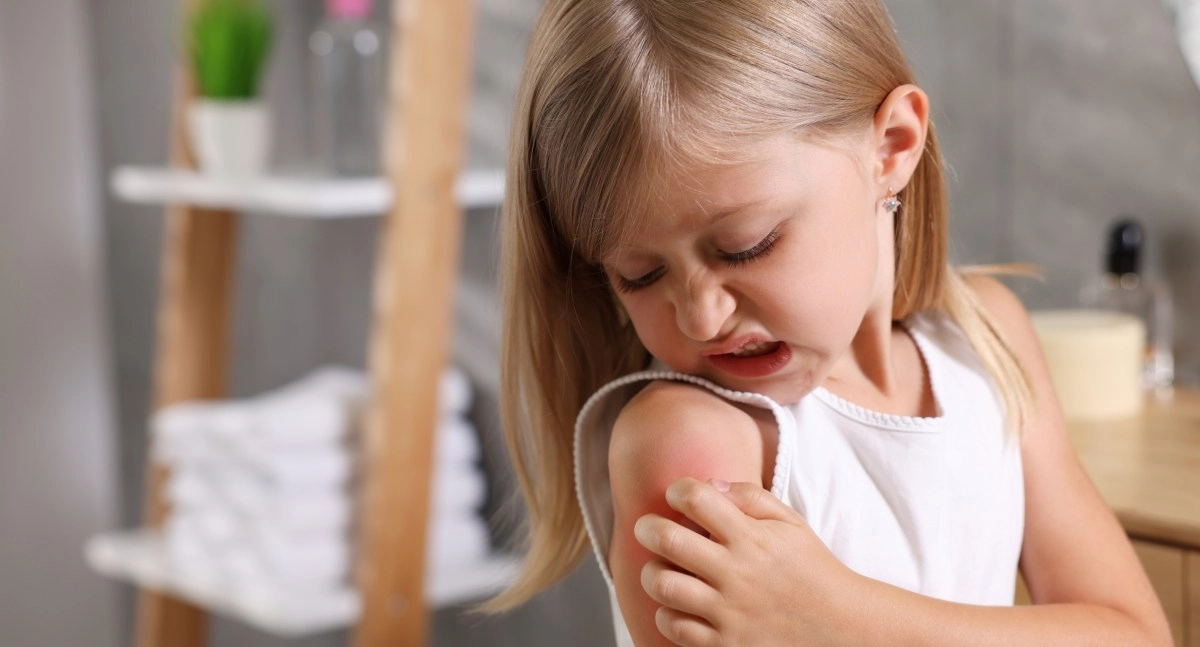 Study reveals the increase in food allergies in children