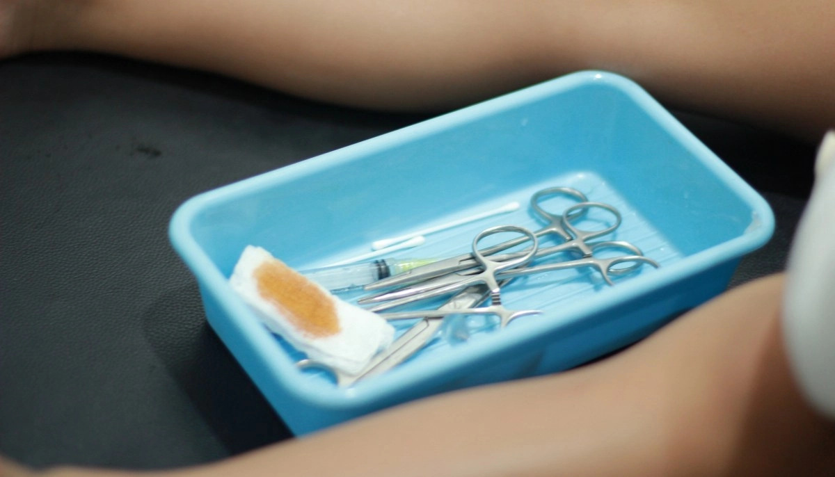 Circumcision in the spotlight health guidelines consider it potentially harmful