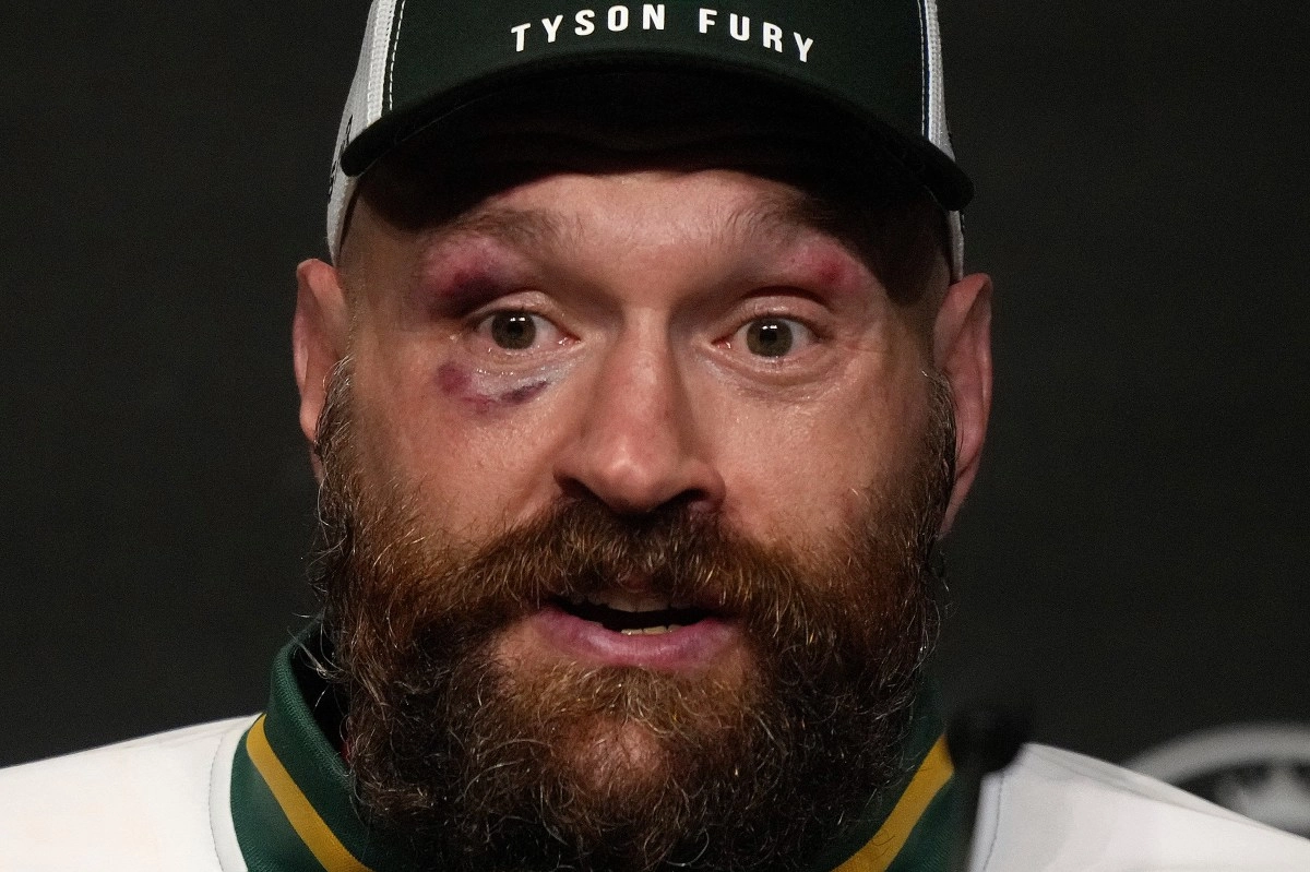 Will there be a fight between Eddie Hearn and Dana White Tyson Fury offers his help