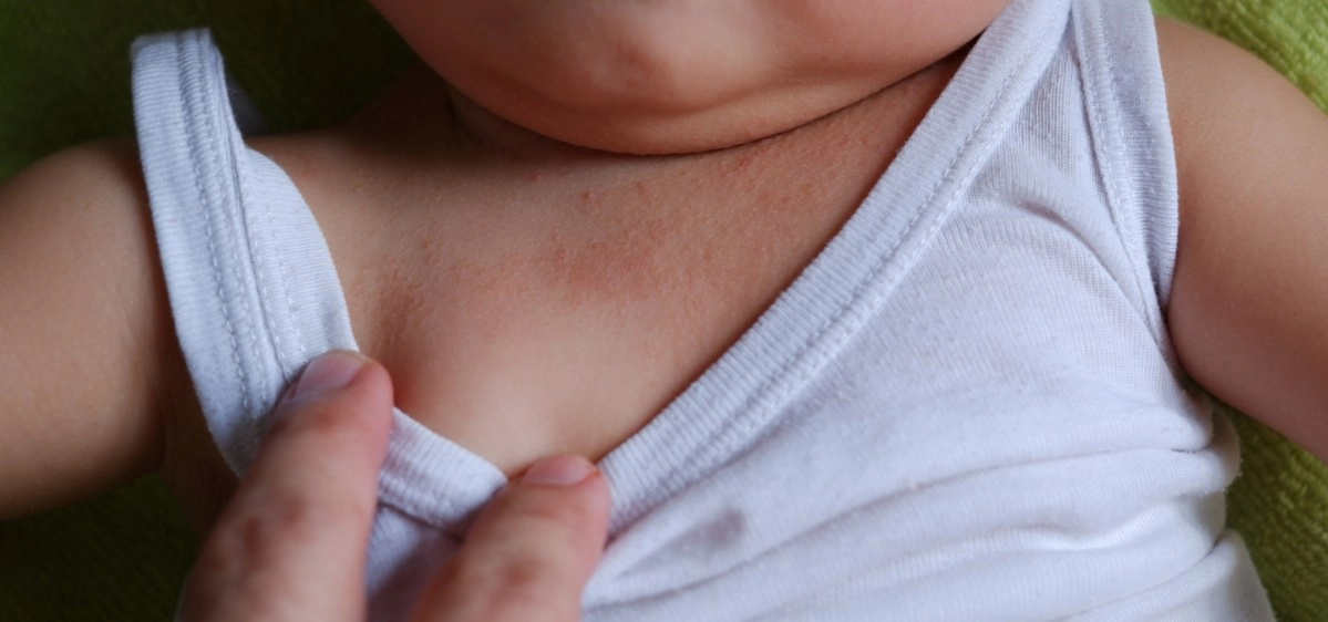 Keys to protect babies from extreme heat in summer