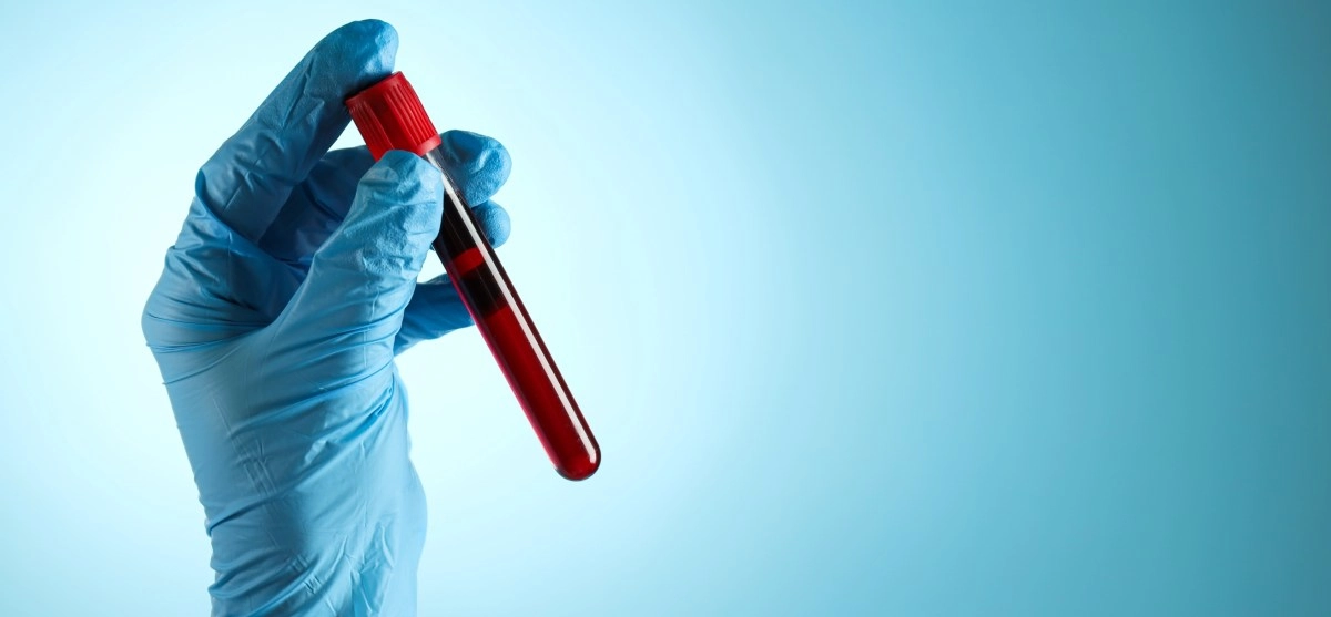 With AI support, a blood test detects hidden heart risks up to 15 years in advance