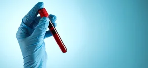 With AI support, a blood test detects hidden heart risks up to 15 years in advance
